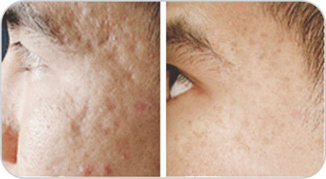 Before and After1 Prima e dopo1