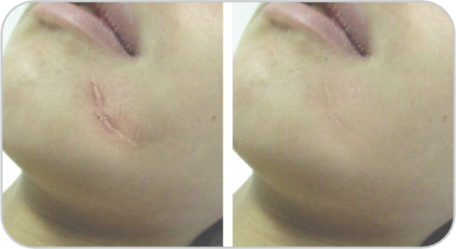 Before and After2 Prima e dopo2