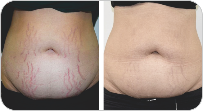 Before and After3 Prima e dopo3