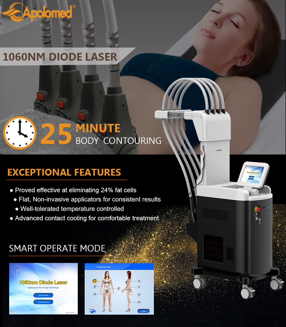 1060nm sculpture diode laser Laser a diodi per scultura da 1060 nm