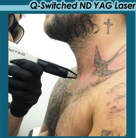 Attrezzatura laser QS 1