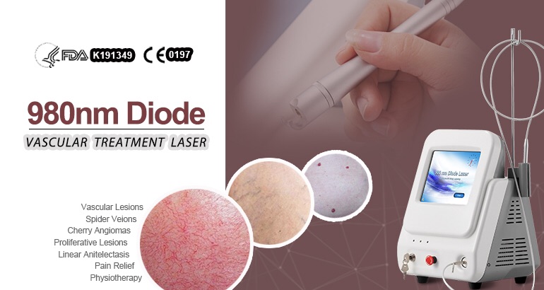 Macchina per la rimozione vascolare con laser a diodi 980 nm
