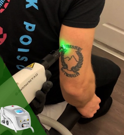 Attrezzatura laser QS 2 