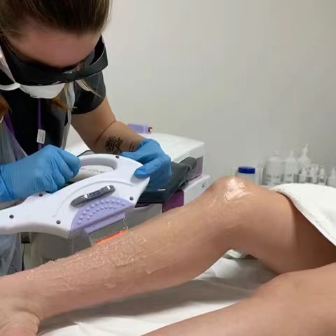 Quanto costa davvero la depilazione dei capelli laser