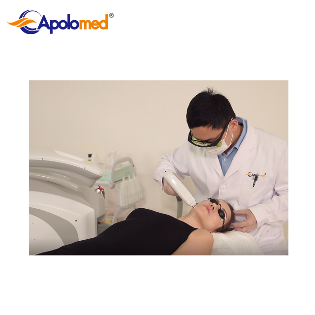 Rimozione dei capelli laser sicuri ed efficaci per aree sensibili