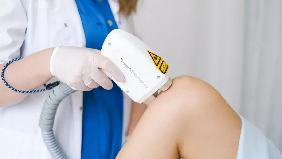 Quali tipi di capelli non possono essere laser