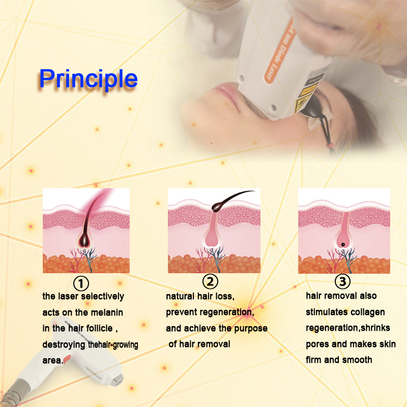 La macchina laser a diodi è efficace?