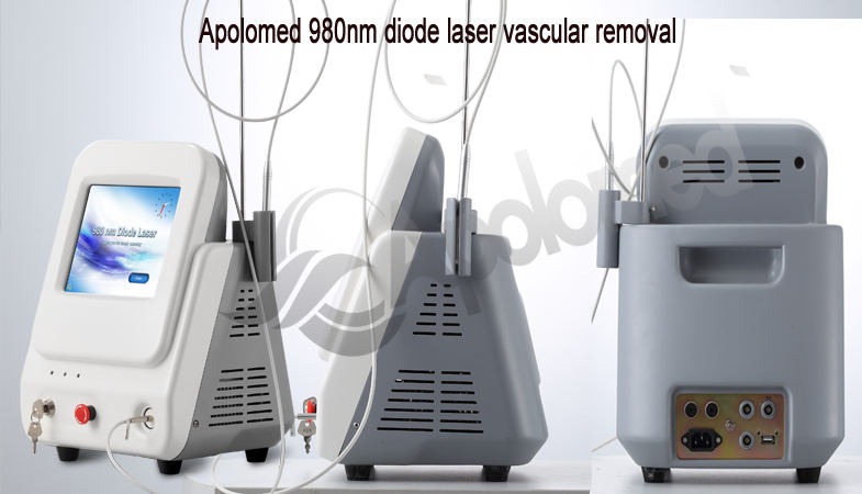 apparecchiatura laser a diodi 980nm per la rimozione vascolare